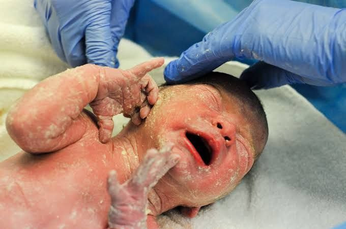 Vernix caseosa
